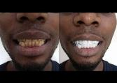 Oral Care