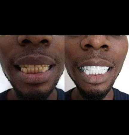 Oral Care